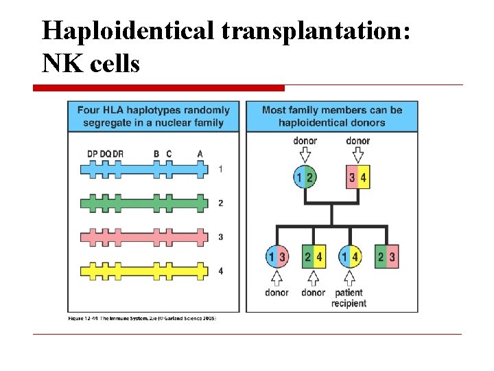 Haploidentical transplantation: NK cells 