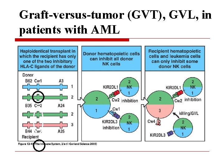 Graft-versus-tumor (GVT), GVL, in patients with AML 