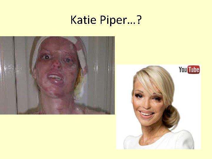 Katie Piper…? 