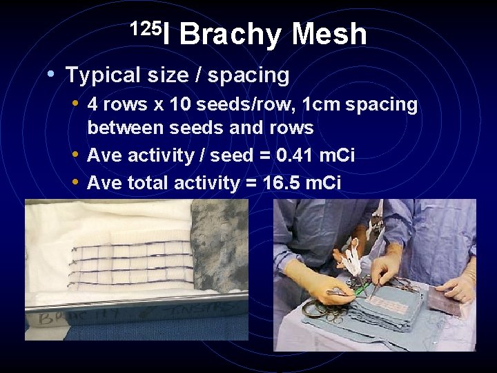 125 I Brachy Mesh • Typical size / spacing • 4 rows x 10