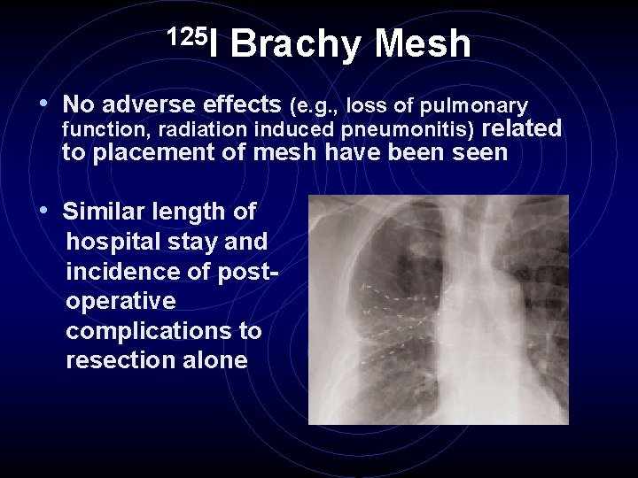 125 I Brachy Mesh • No adverse effects (e. g. , loss of pulmonary