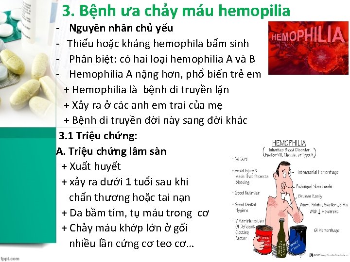 3. Bệnh ưa chảy máu hemopilia - Nguyên nhân chủ yếu - Thiếu hoặc