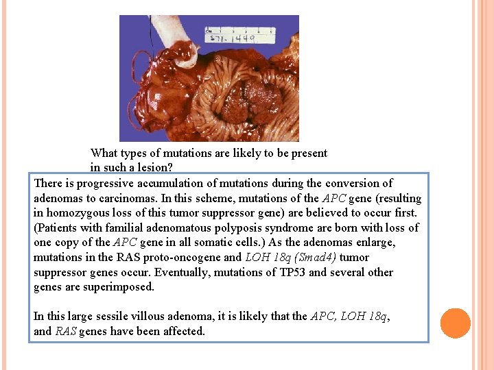 What types of mutations are likely to be present in such a lesion? There