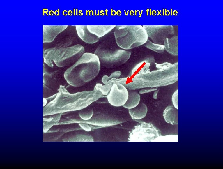 Red cells must be very flexible 