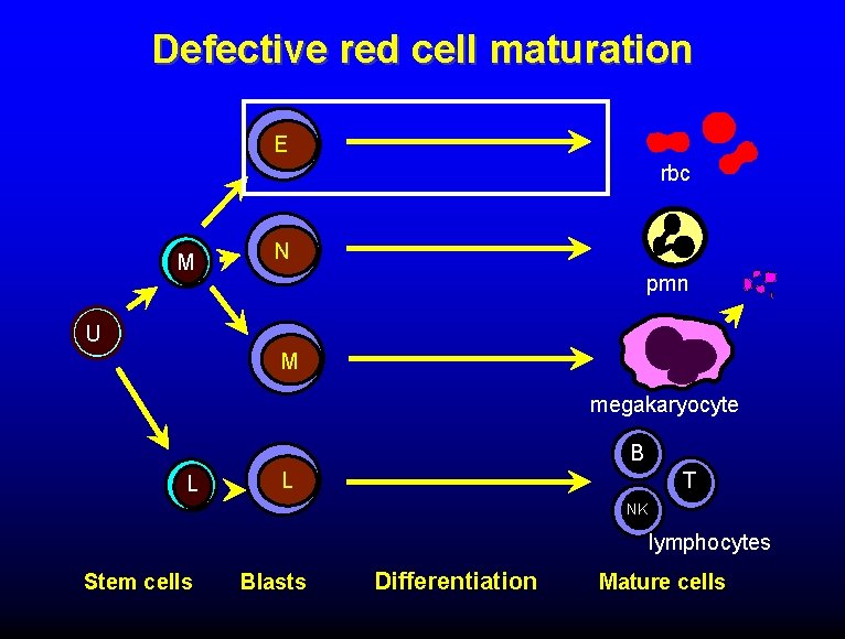 Defective red cell maturation E rbc M N pmn U M megakaryocyte B L