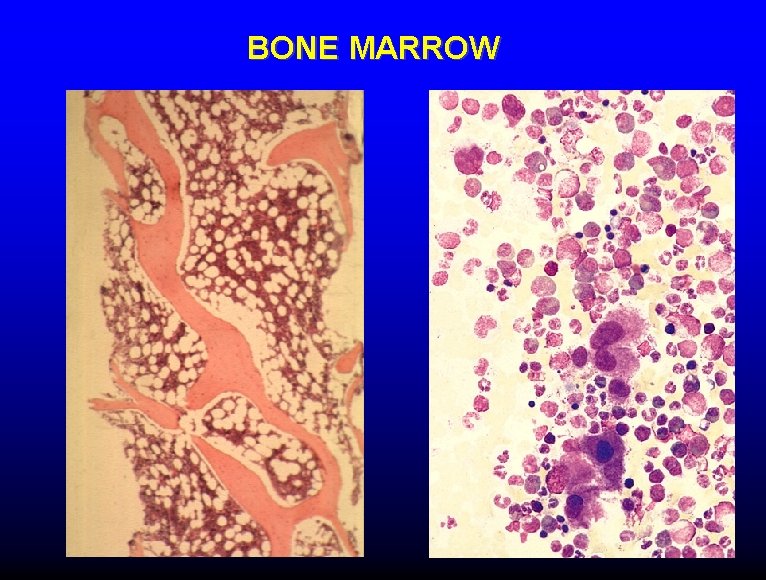 BONE MARROW 