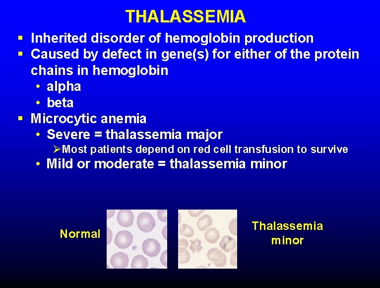 THALASSEMIA § Inherited disorder of hemoglobin production § Caused by defect in gene(s) for