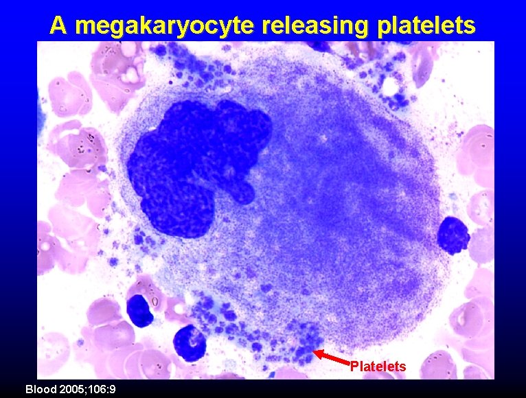A megakaryocyte releasing platelets Platelets Blood 2005; 106: 9 
