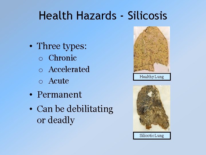 Health Hazards - Silicosis o Chronic o Accelerated o Acute CDC • Three types: