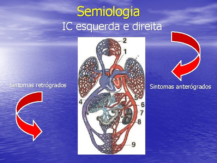 Semiologia IC esquerda e direita Sintomas retrógrados Sintomas anterógrados 