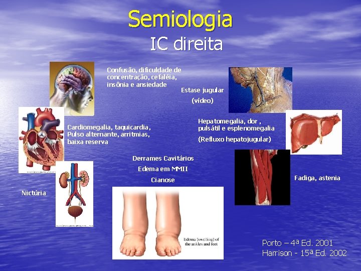 Semiologia IC direita Confusão, dificuldade de concentração, cefaléia, insônia e ansiedade Estase jugular (vídeo)