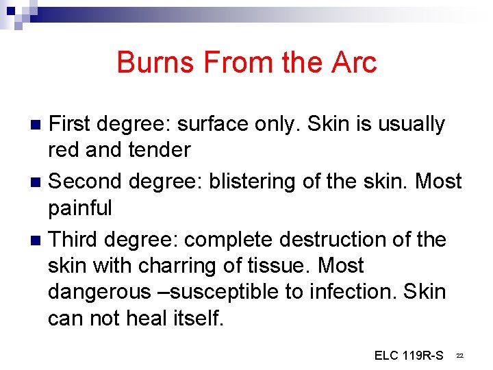 Burns From the Arc First degree: surface only. Skin is usually red and tender