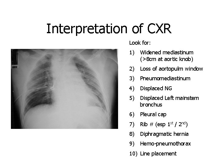 Interpretation of CXR Look for: 1) Widened mediastinum (>8 cm at aortic knob) 2)
