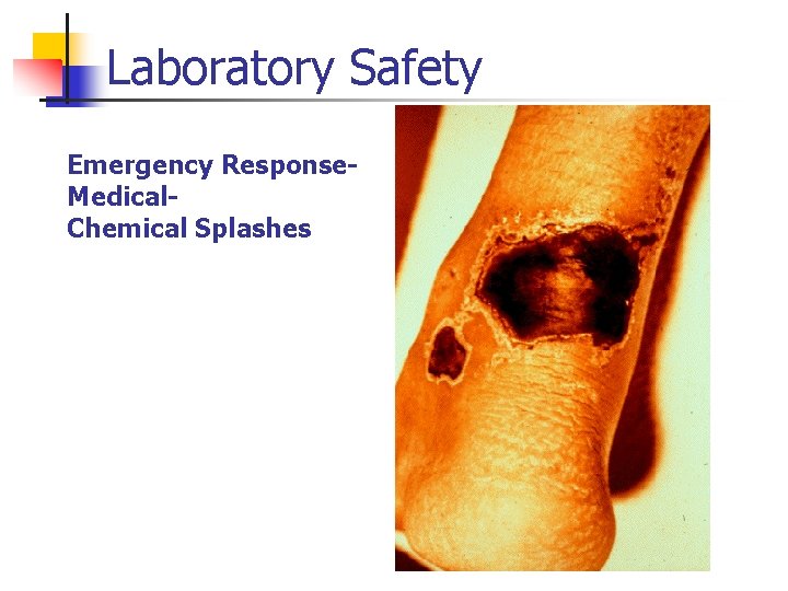 Laboratory Safety Emergency Response. Medical. Chemical Splashes 