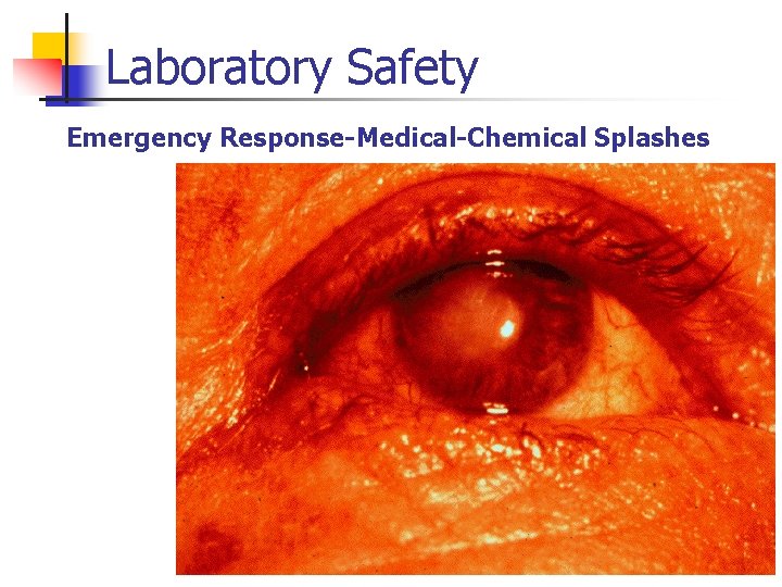 Laboratory Safety Emergency Response-Medical-Chemical Splashes 