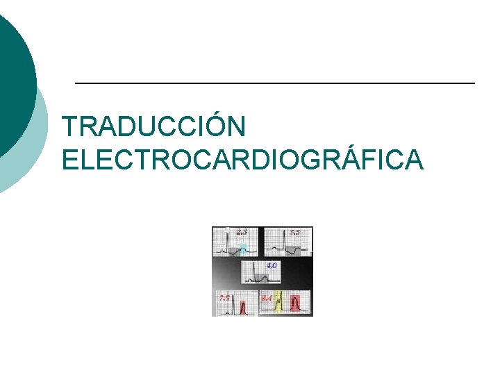 TRADUCCIÓN ELECTROCARDIOGRÁFICA 