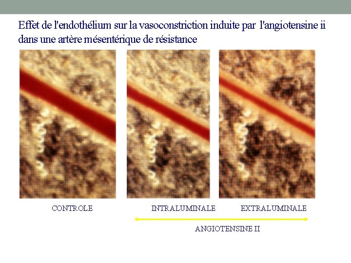 Effet de l'endothélium sur la vasoconstriction induite par l'angiotensine ii dans une artère mésentérique