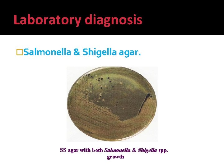 Laboratory diagnosis �Salmonella & Shigella agar. SS agar with both Salmonella & Shigella spp.