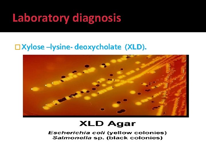 Laboratory diagnosis � Xylose –lysine- deoxycholate (XLD). 