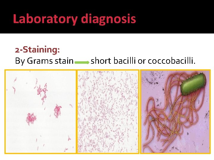 Laboratory diagnosis 2 -Staining: By Grams stain short bacilli or coccobacilli. 