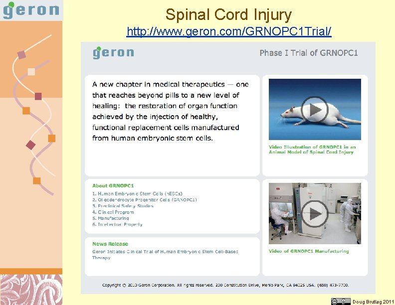 Spinal Cord Injury http: //www. geron. com/GRNOPC 1 Trial/ Doug Brutlag 2011 