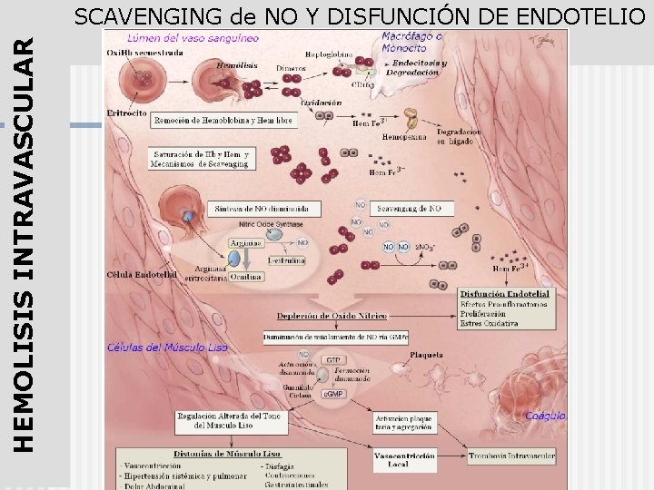 HEMOLISIS INTRAVASCULAR SCAVENGING de NO Y DISFUNCIÓN DE ENDOTELIO 