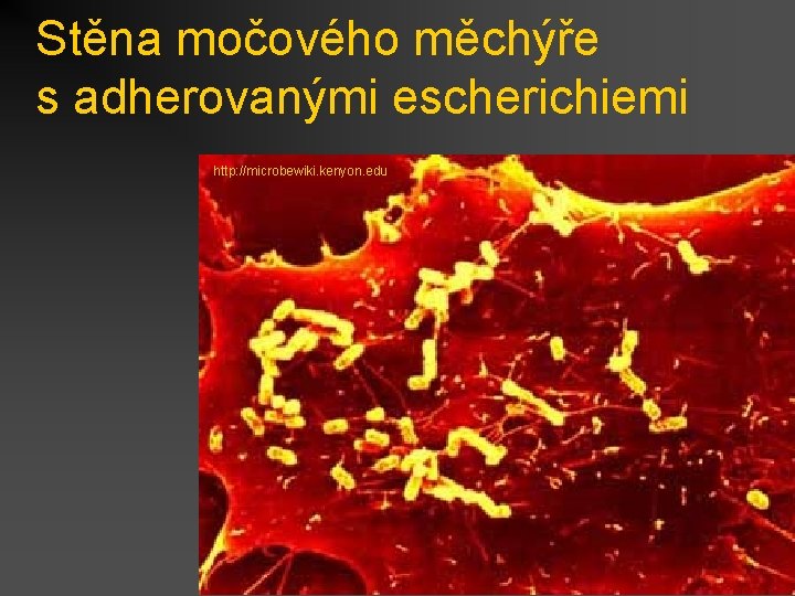 Stěna močového měchýře s adherovanými escherichiemi http: //microbewiki. kenyon. edu 