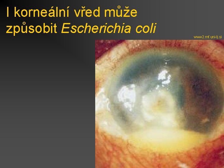 I korneální vřed může způsobit Escherichia coli www 2. mf. uni-lj. si 
