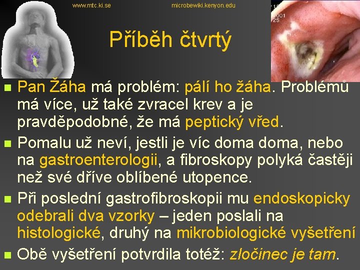 www. mtc. ki. se microbewiki. kenyon. edu Příběh čtvrtý n n Pan Žáha má