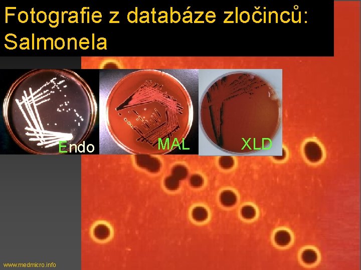 Fotografie z databáze zločinců: Salmonela Endo www. medmicro. info MAL XLD 