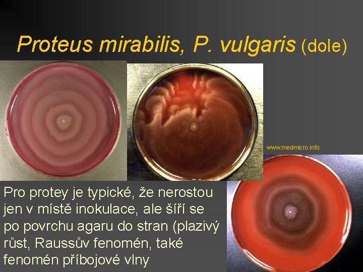 Proteus mirabilis, P. vulgaris (dole) www. medmicro. info Pro protey je typické, že nerostou