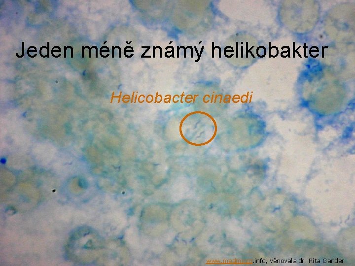 Jeden méně známý helikobakter Helicobacter cinaedi www. medmicro. info, věnovala dr. Rita Gander 