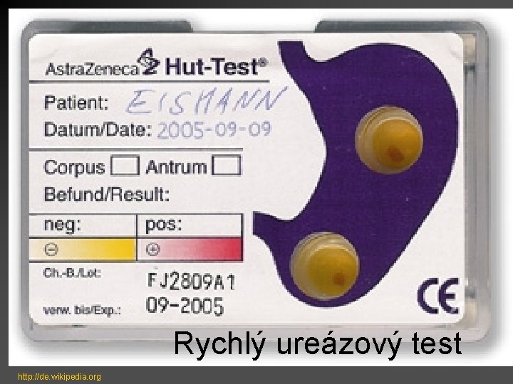 Rychlý ureázový test http: //de. wikipedia. org 