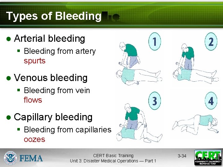 Types of Bleeding ● Arterial bleeding § Bleeding from artery spurts. ● Venous bleeding