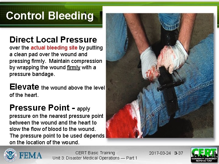 Control Bleeding Direct Local Pressure over the actual bleeding site by putting a clean