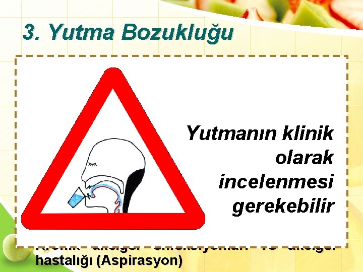 3. Yutma Bozukluğu • • • Besinlere karşı isteksizlik Beslenme sırasında kasların gerilmesi Beslenme