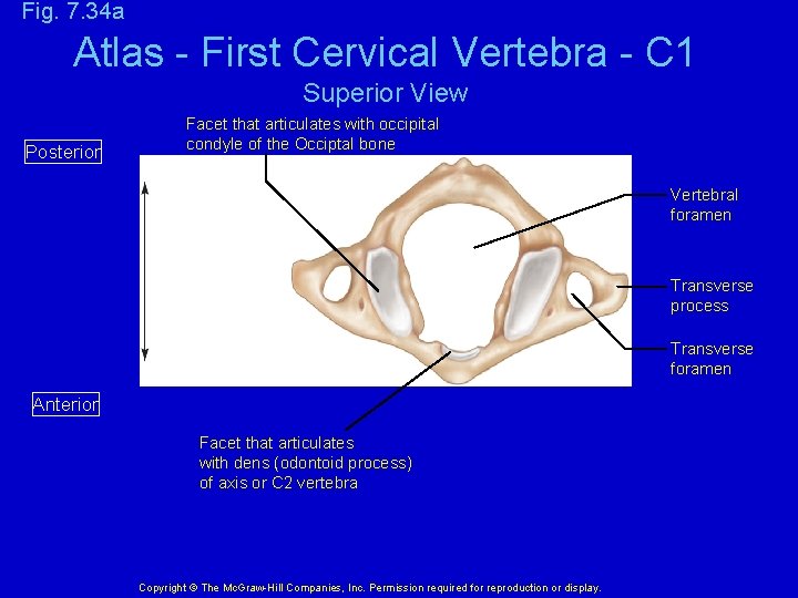 Fig. 7. 34 a Atlas - First Cervical Vertebra - C 1 Superior View