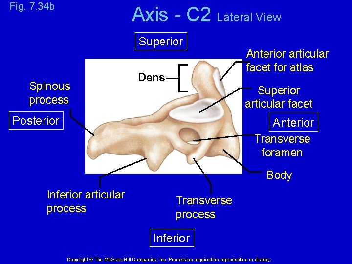 Fig. 7. 34 b Axis - C 2 Lateral View Superior Spinous process Dens