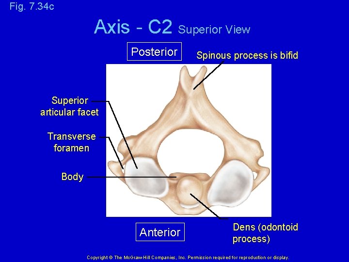 Fig. 7. 34 c Axis - C 2 Superior View Posterior Spinous process is