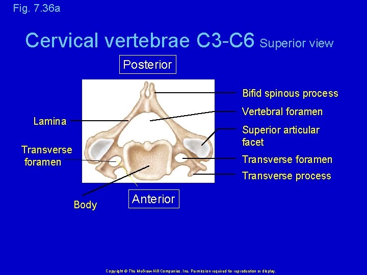 Fig. 7. 36 a Cervical vertebrae C 3 -C 6 Superior view Posterior Bifid