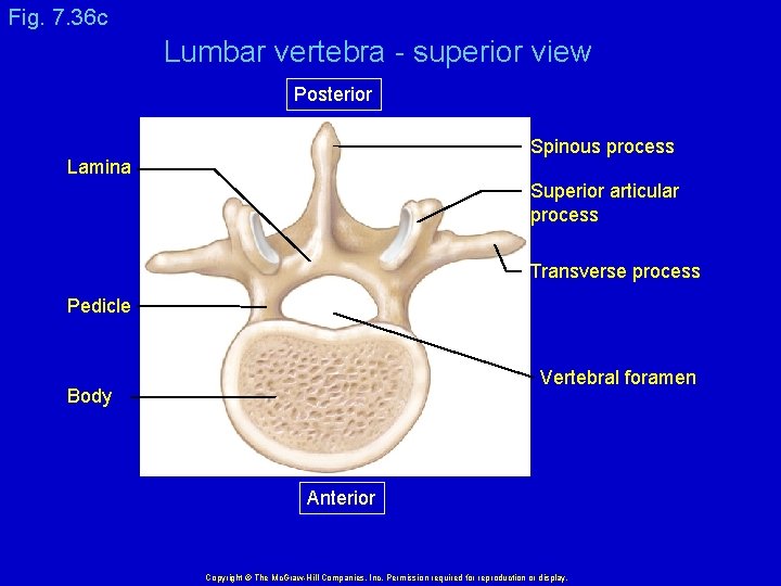 Fig. 7. 36 c Lumbar vertebra - superior view Posterior Spinous process Lamina Superior