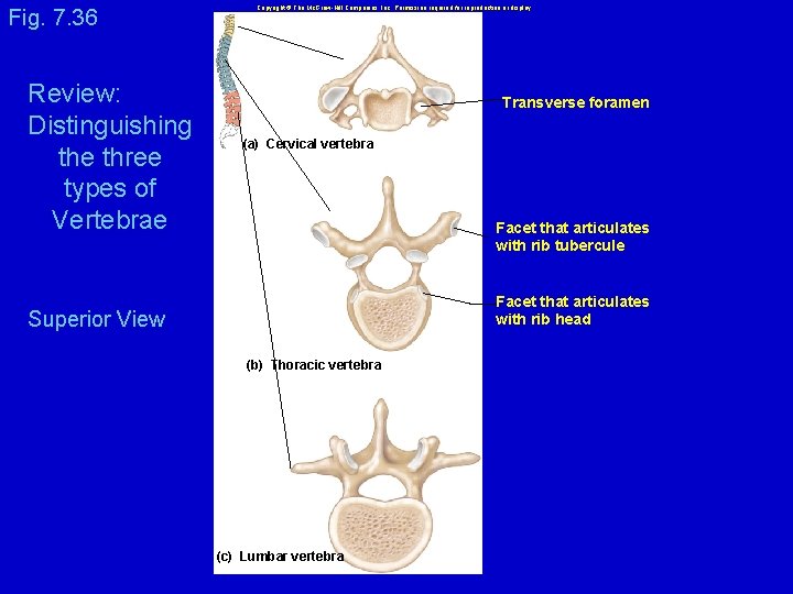 Anatomy and Physiology I Bones of the Vertebral