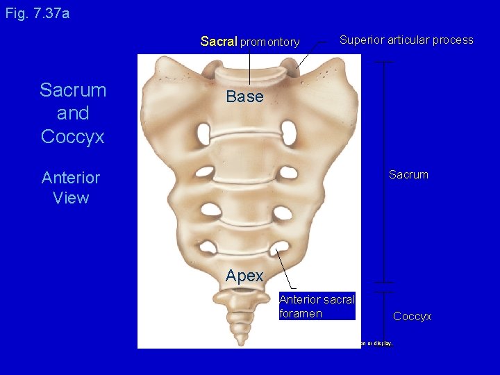 Fig. 7. 37 a Sacral promontory Sacrum and Coccyx Superior articular process Base Sacrum