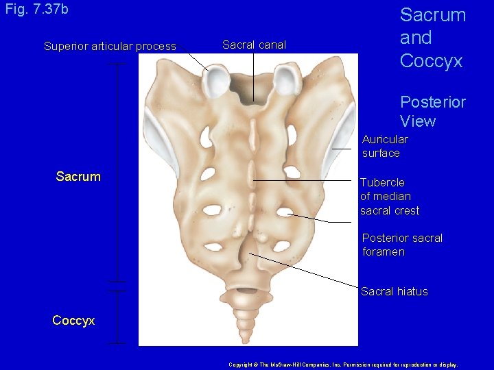 Fig. 7. 37 b Superior articular process Sacral canal Sacrum and Coccyx Posterior View
