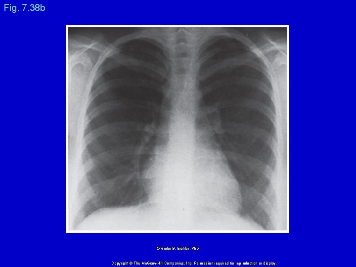 Fig. 7. 38 b © Victor B. Eichler, Ph. D Copyright © The Mc.
