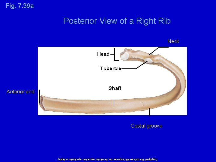 Copyright © The Mc. Graw-Hill Companies, Inc. Permission required for reproduction or display. Anterior