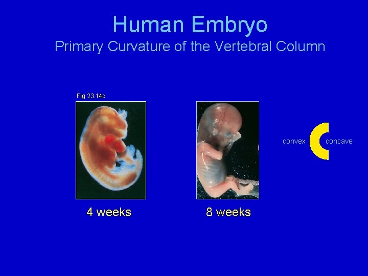 Human Embryo Primary Curvature of the Vertebral Column Fig 23. 14 c convex 4
