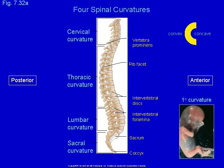 Fig. 7. 32 a Four Spinal Curvatures Cervical curvature convex concave Vertebra prominens Rib