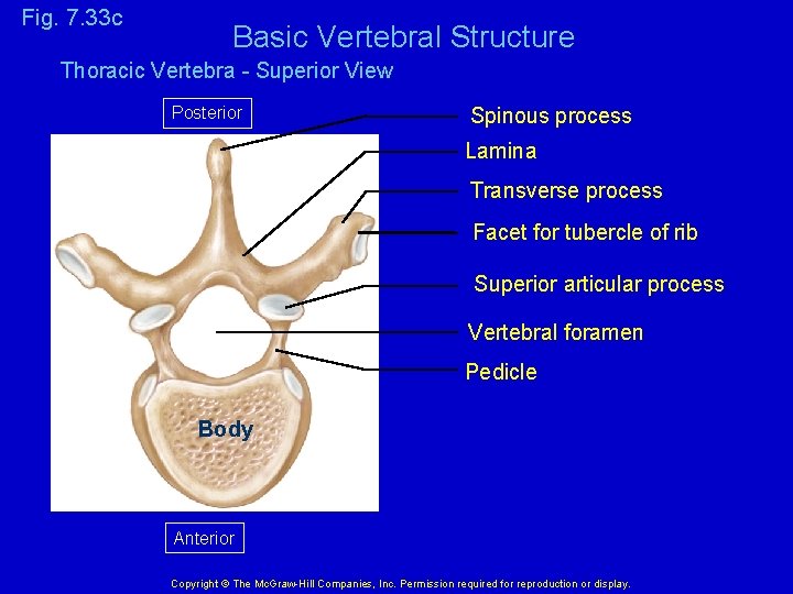 Fig. 7. 33 c Basic Vertebral Structure Thoracic Vertebra - Superior View Posterior Spinous