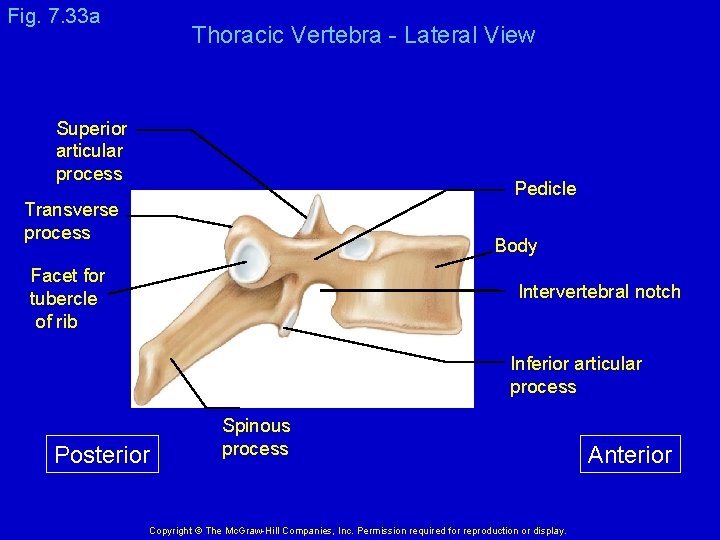 Fig. 7. 33 a Thoracic Vertebra - Lateral View Superior articular process Pedicle Transverse